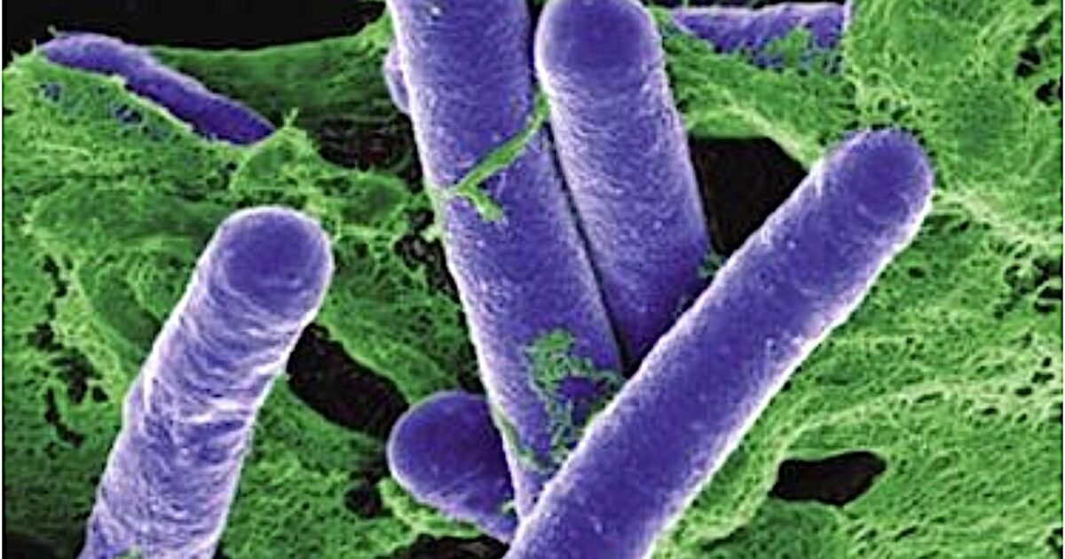 Symptoms Of E Coli Infection About E Coli