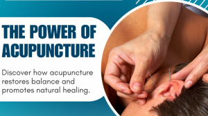 The Incredible Benefits of Acupuncture for Holistic Health