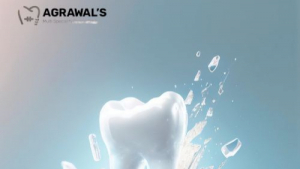 Teeth Cleaning in Ahmedabad: Your Path to a Healthier Smile
