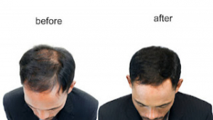 LOOKING FOR HAIR REPLACEMENT OR HAIR  EXTENTION 