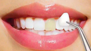Family dentist in Laurel, MD