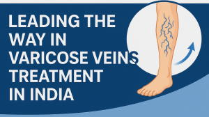 Leading the Way in Varicose Veins Treatment in India