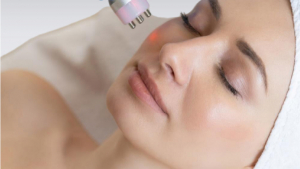 Discover Brighter, Even-Toned Skin with Laser Toning in Delhi