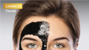 Get Instant Glow and Deep Cleansing with Carbon Facial Peels in Delhi
