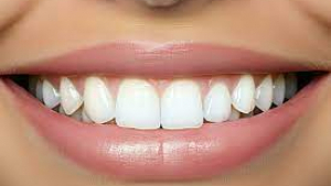 How Often Should I Visit a Dental Clinic for Checkups?