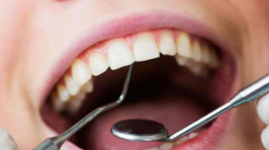 How Long Does Orthodontic Treatment Usually Take?