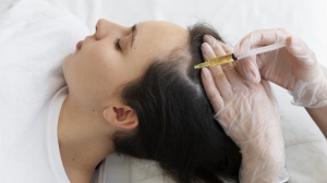 PRP Hair Treatment: Safe and Effective Solutions for Hair Restoration