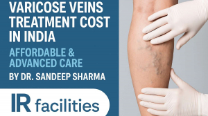 Varicose Veins Treatment Cost in India
