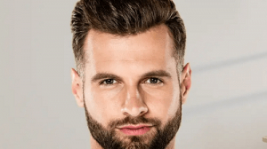 Best Clinics for Beard Hair Transplant in Islamabad