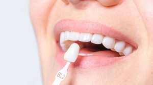 The Ultimate Guide to Pain-Free Dental Implants in Islamabad