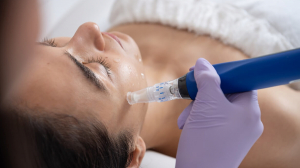 Microneedling in Surrey, BC: Benefits, Process & Results