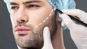 What Are the Risks of Beard Hair Transplant in Islamabad?
