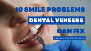 10 Smile Problems Dental Veneers Can Fix