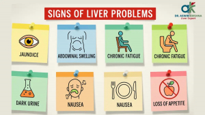 Liver Specialist in Chennai