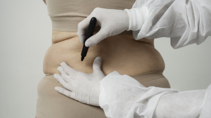 Restoring Volume Post-Weight Loss: The Role Of Butt Fillers In 2026