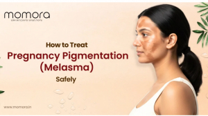 How to treat Pregnancy Pigmentation (Melasma) safely