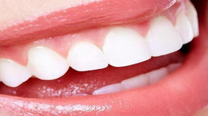 Periodontist in Dubai: Expert Care for Healthy Gums and Strong Smiles
