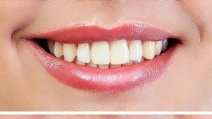 Milestone Dentistry Mississauga – Trusted Dental Clinic in Mississauga Ontario