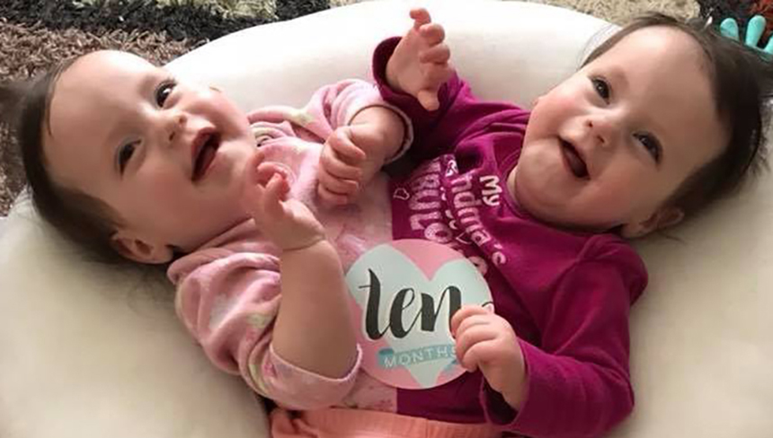 Local Conjoined Twins Celebrate First Christmas East Idaho News