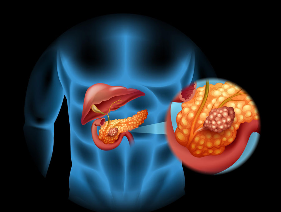 Pancreas