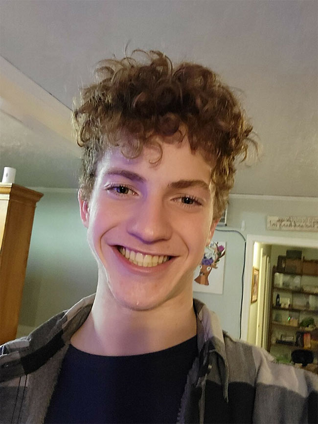 Hayden Hashagen before surgery