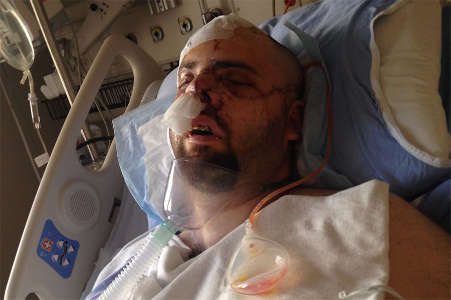 Man attacked by grizzly bear talks about the scary experience with Emmy
