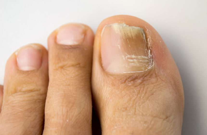 AdobeStock 100083456 scaled e1684556574328