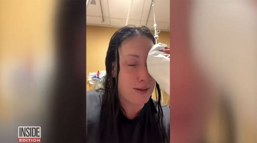You have to see this! Woman mistakes glue for eye drops, glues eye shut