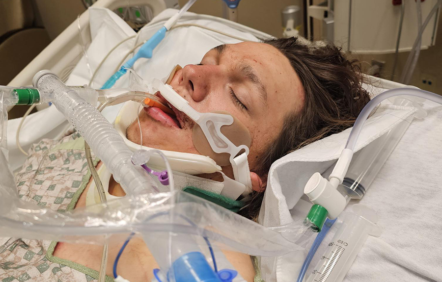 ‘I feel like a train hit me.’ Local man shares miraculous story of survival after being hit by lightning