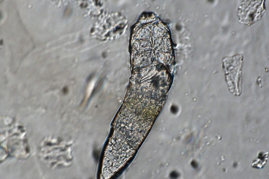 demodex mites