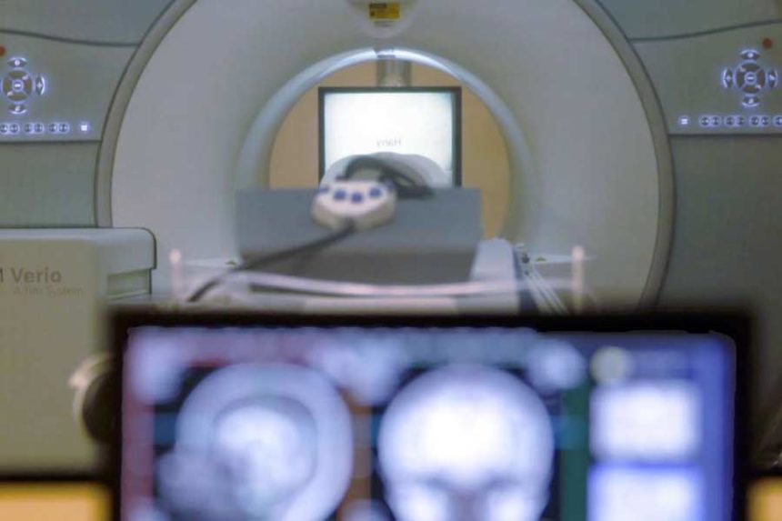A brain-scanning MRI machine is seen in Pittsburgh, Nov. 26, 2014. A man died after he was pulled into an MRI machine in New York after he walked into the room wearing a large chain necklace, police said. (Keith Srakocic, Associated Press)