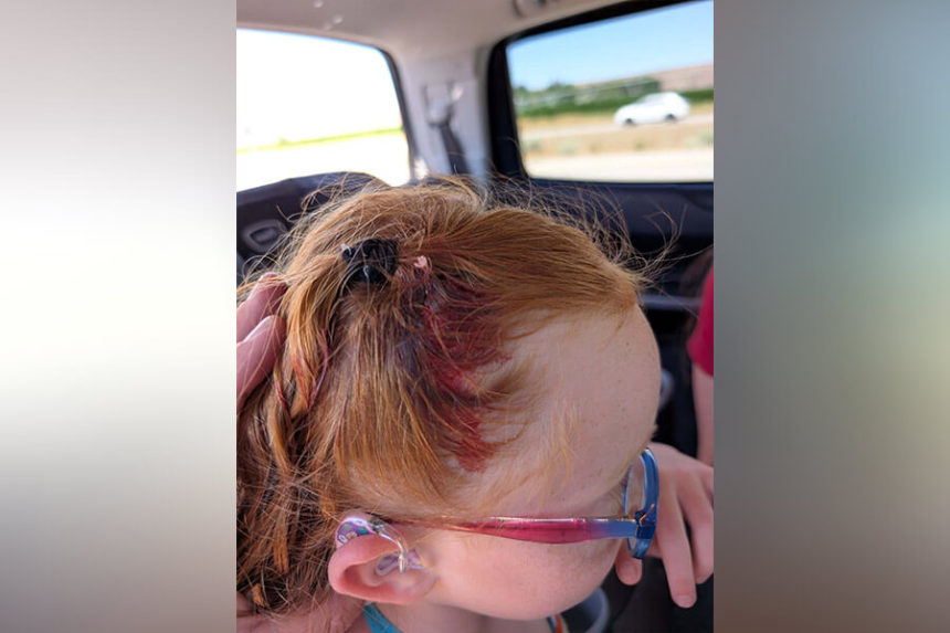 stray bullet damage to child