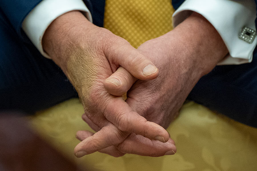 Trump's hands