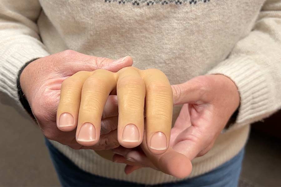 Cosmetic cover for a prosthetic hand at OrthoPro in Idaho Falls. | Rett Nelson, EastIdahoNews.com