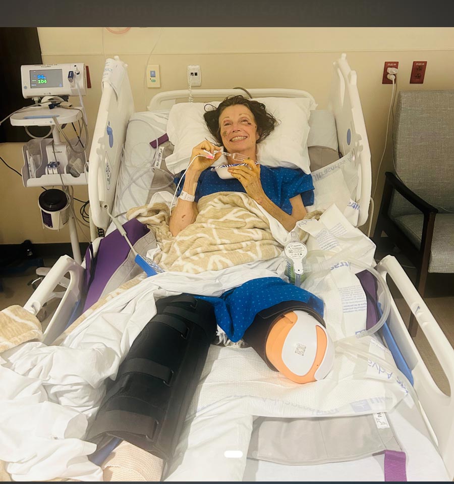 Utah mom who lost both legs in crash helps another mother begin the same journey