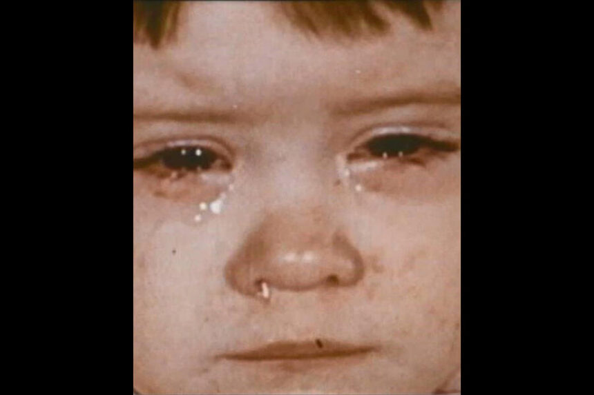 face of girl with measles