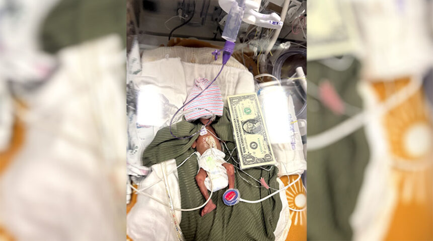 Zander Jensen was born at 23 weeks weighing 354 grams.