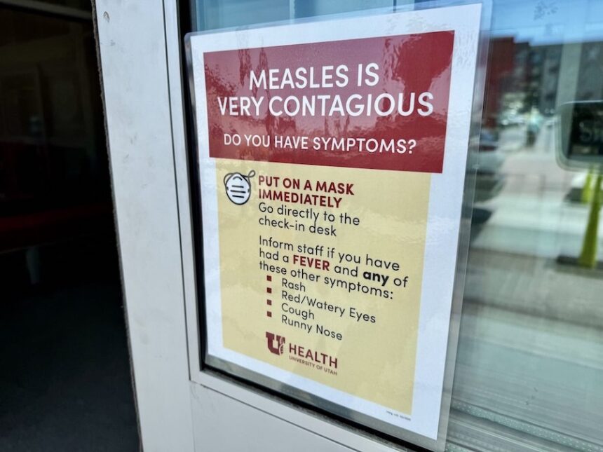 measles sign
