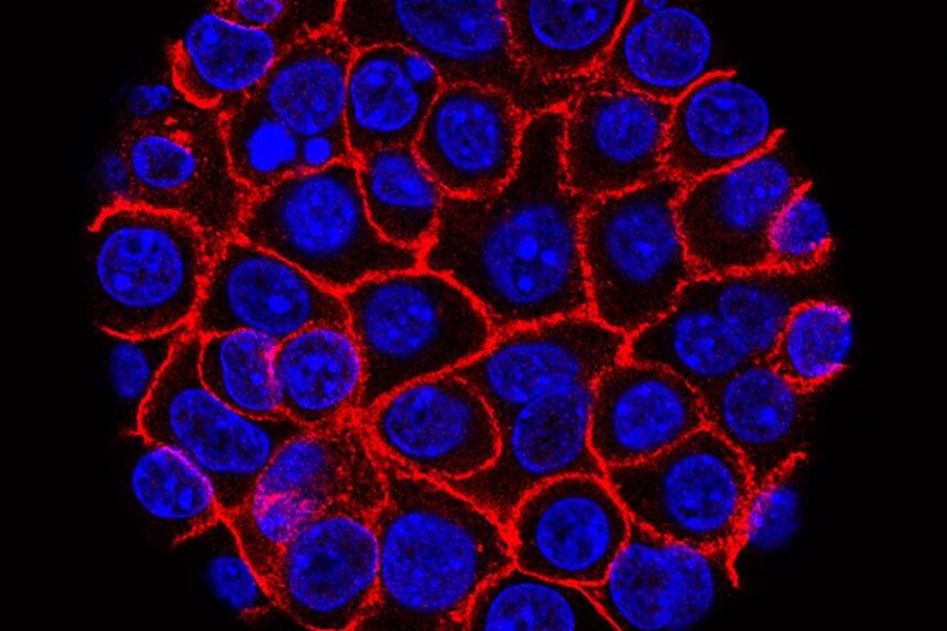 FILE - This undated microscope image from USC via the NIH shows pancreatic cancer cells, nuclei in blue, growing as a sphere encased in membranes, red.