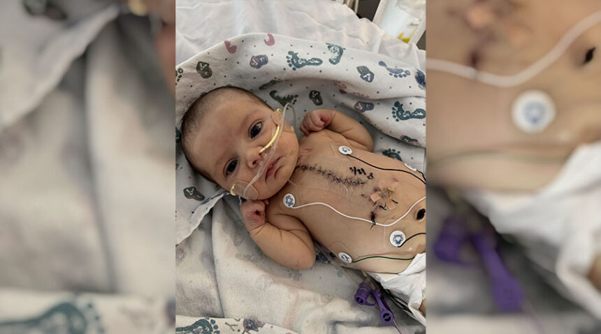 Auzzy Price was born with Hypoplastic left heart syndrome.