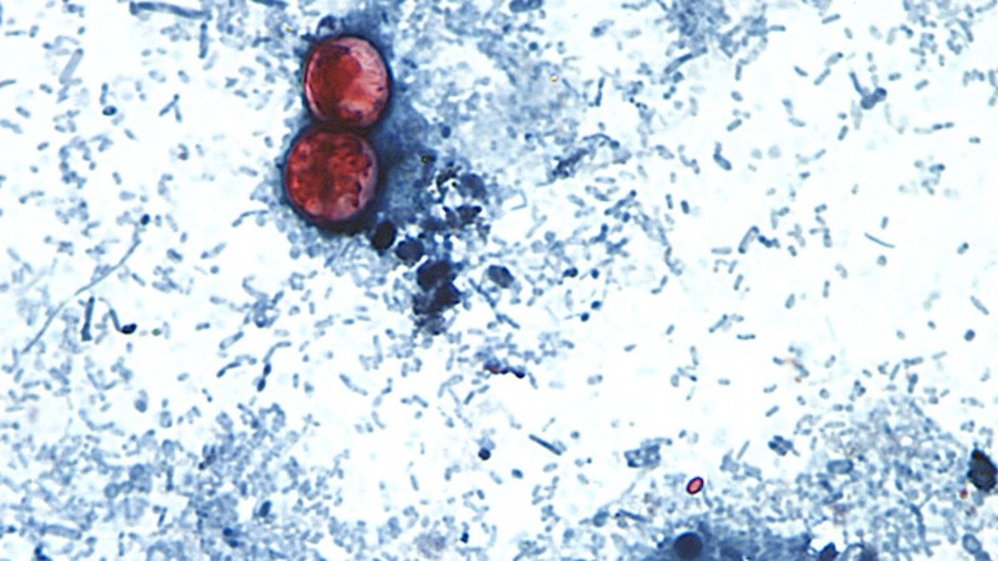 Diarrhea-causing parasite that can contaminate raw produce causing misery across several states