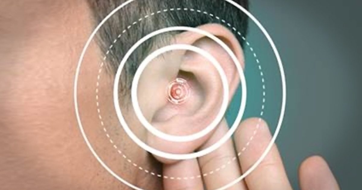 Technologies Used In Education Of Hearing Impaired Individuals Technologies Used In Education Of Hearing Impaired Individuals