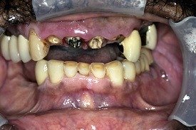 Before