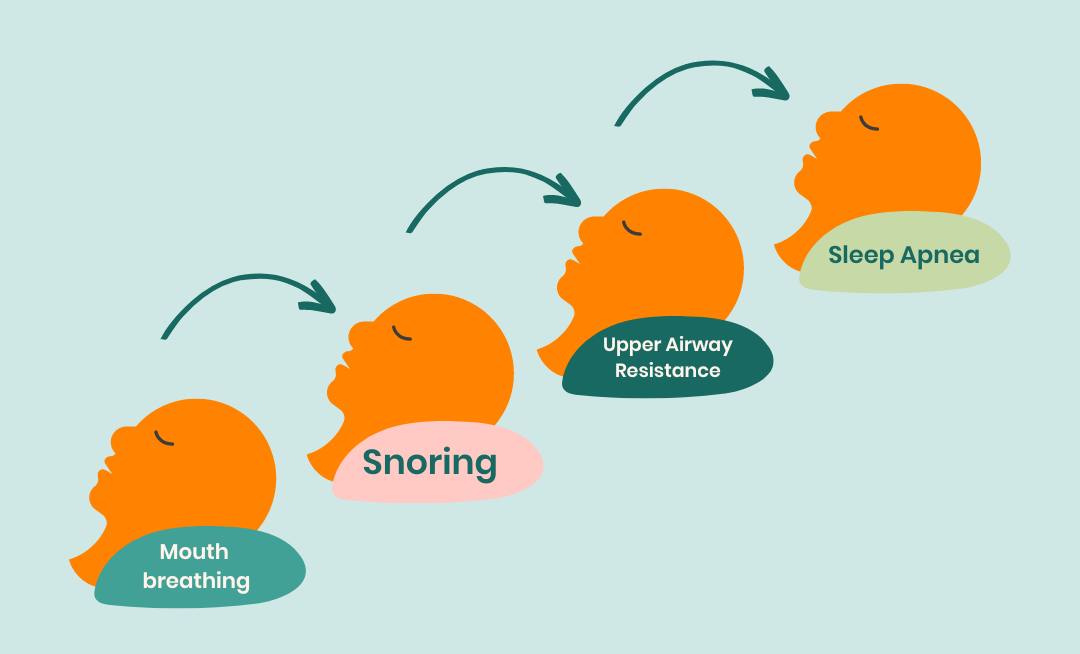 Diagram showing the Sleep Disordered Breathing spectrum in children, progressing from mouth breathing to snoring, upper airway resistance, and sleep apnea.