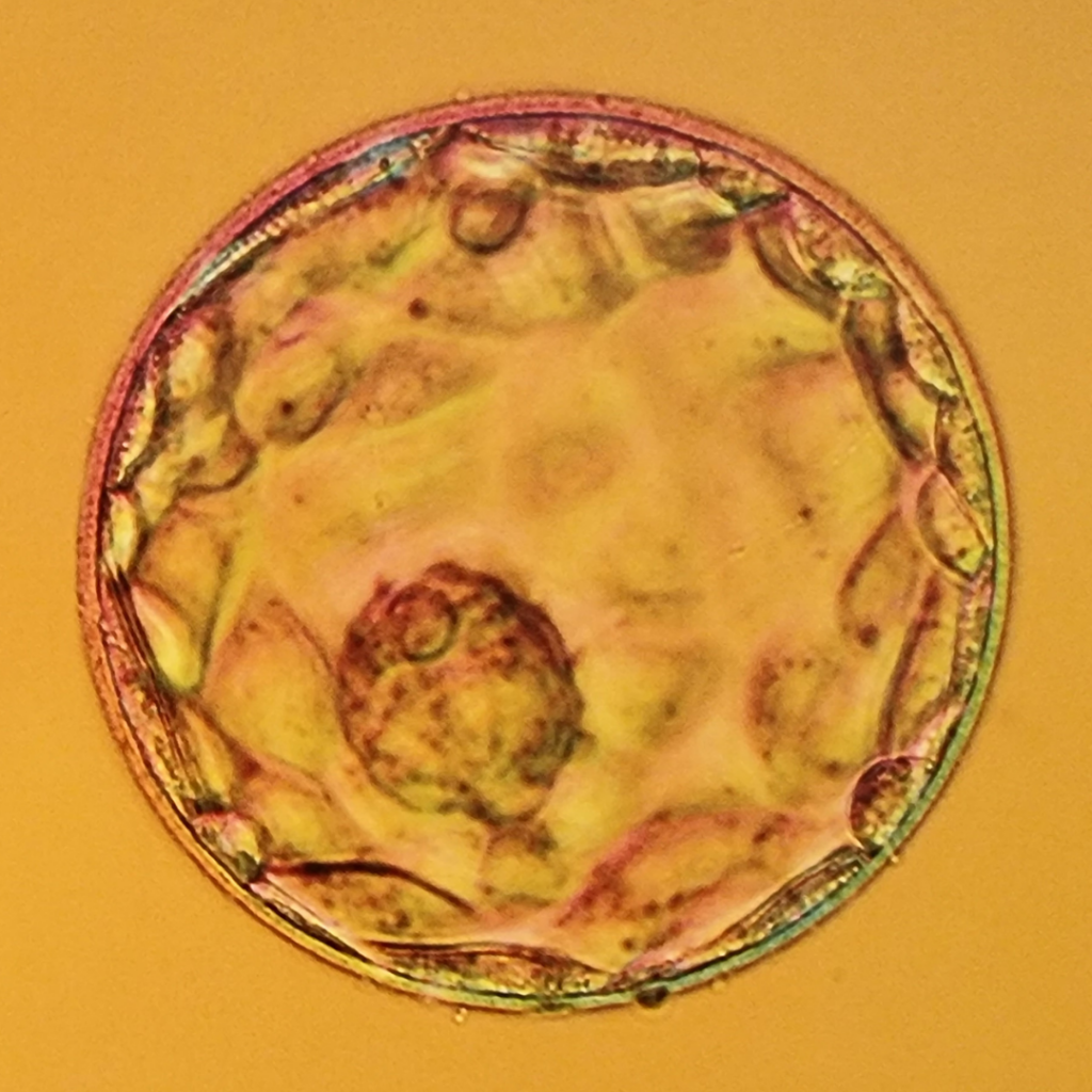 Day 5 blastocyst