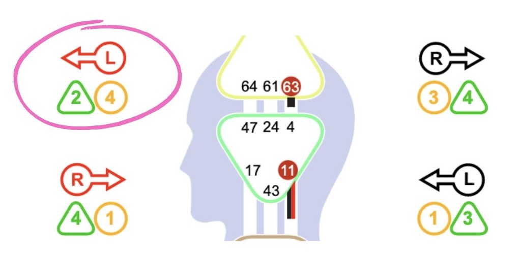 human design determination variable