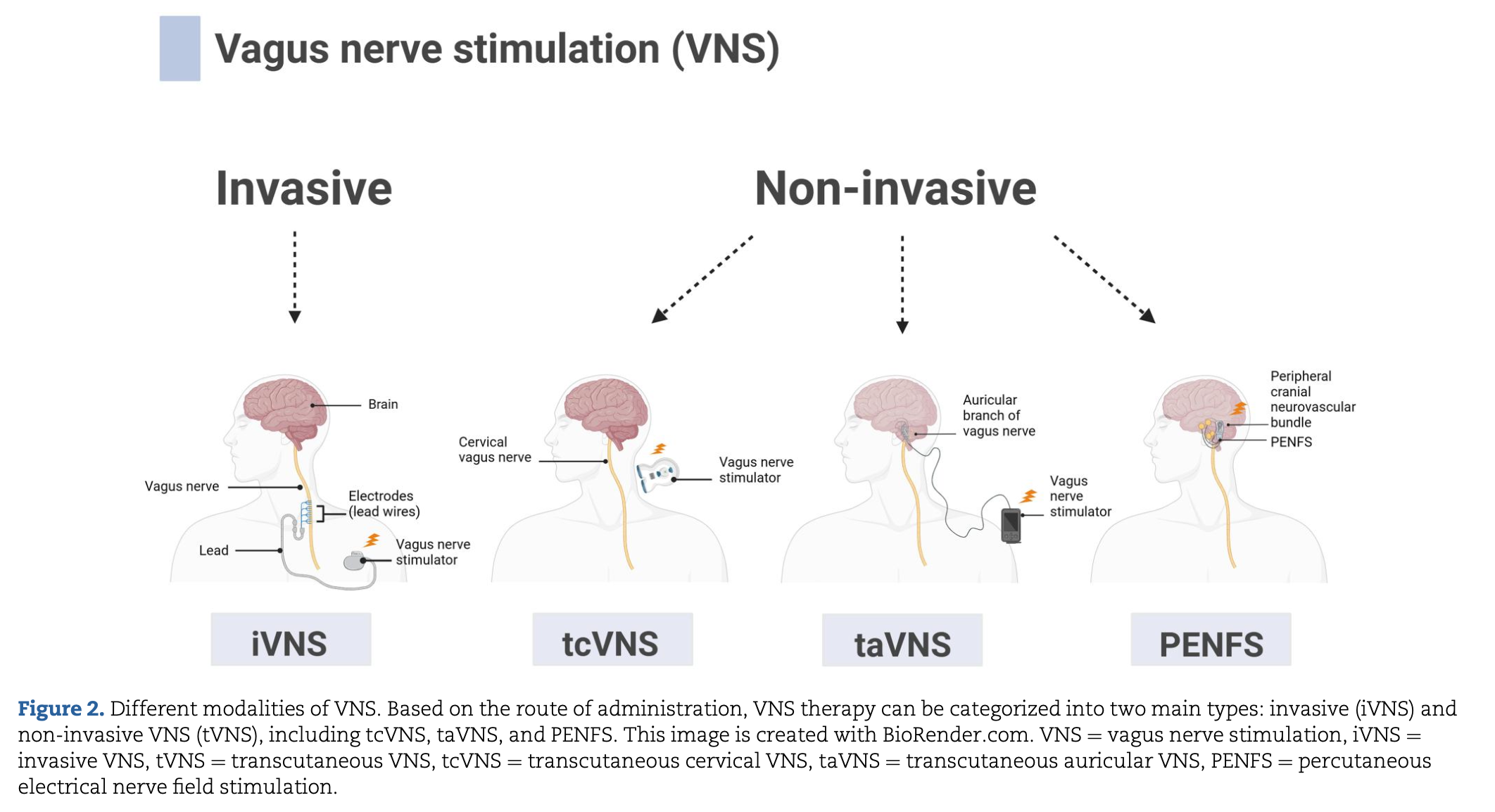 stimulation du nerf vague