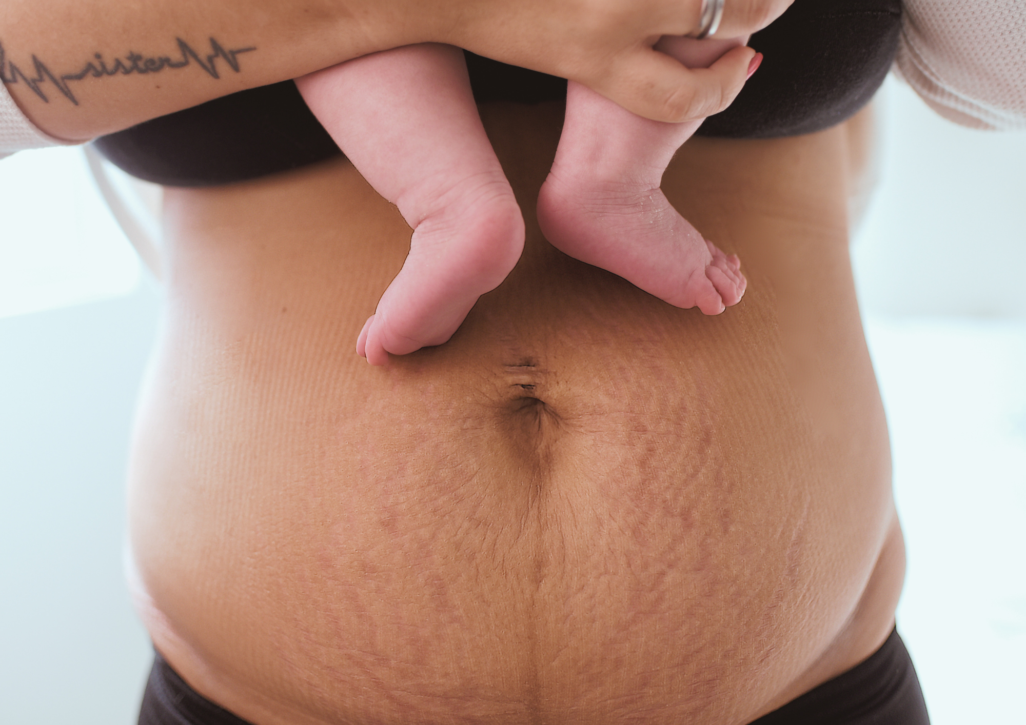 Ventre d'une femme en post-partum