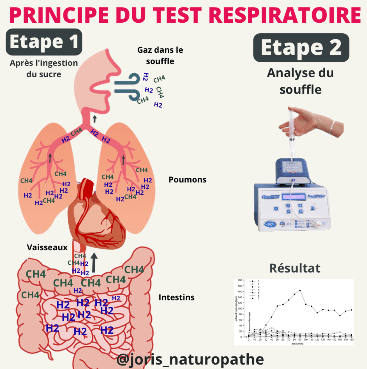 test respiratoire sibo