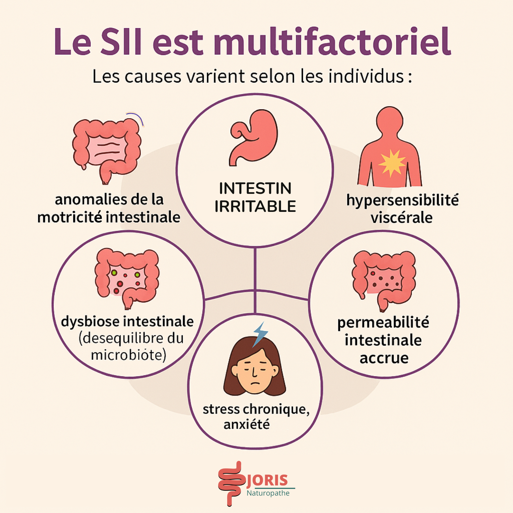 intestin irritable causes